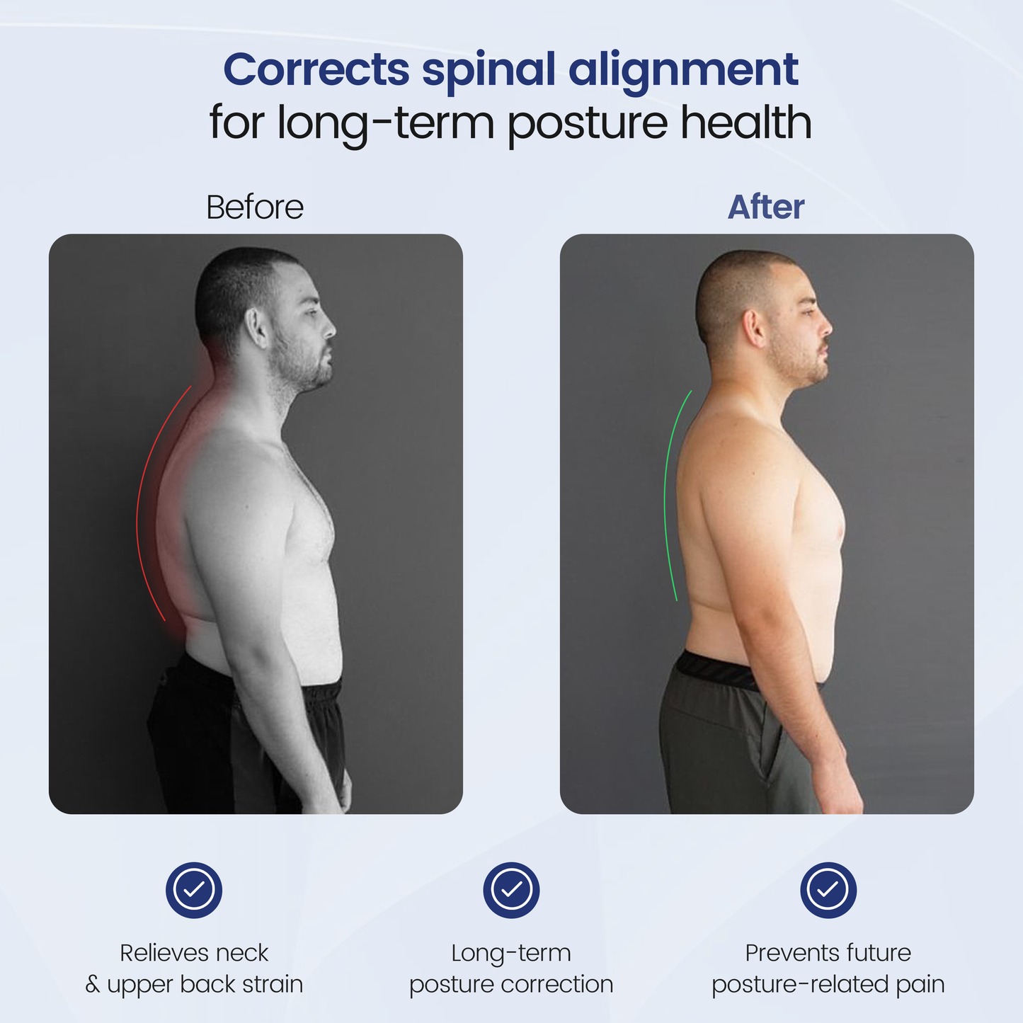 Align™ Posture Corrector