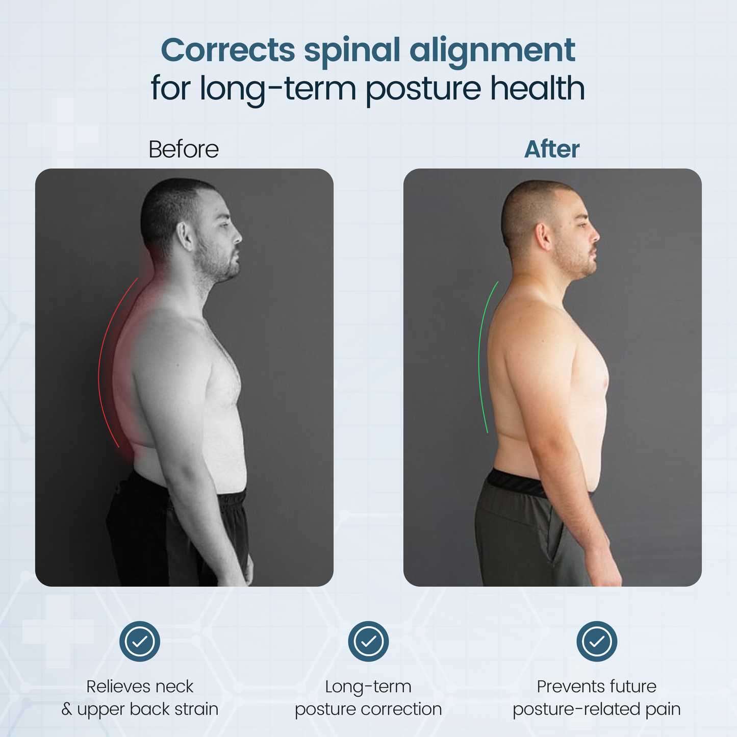 Irries™ Posture Corrector