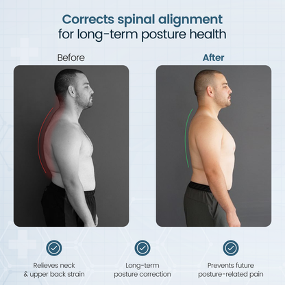 Irries™ Posture Corrector